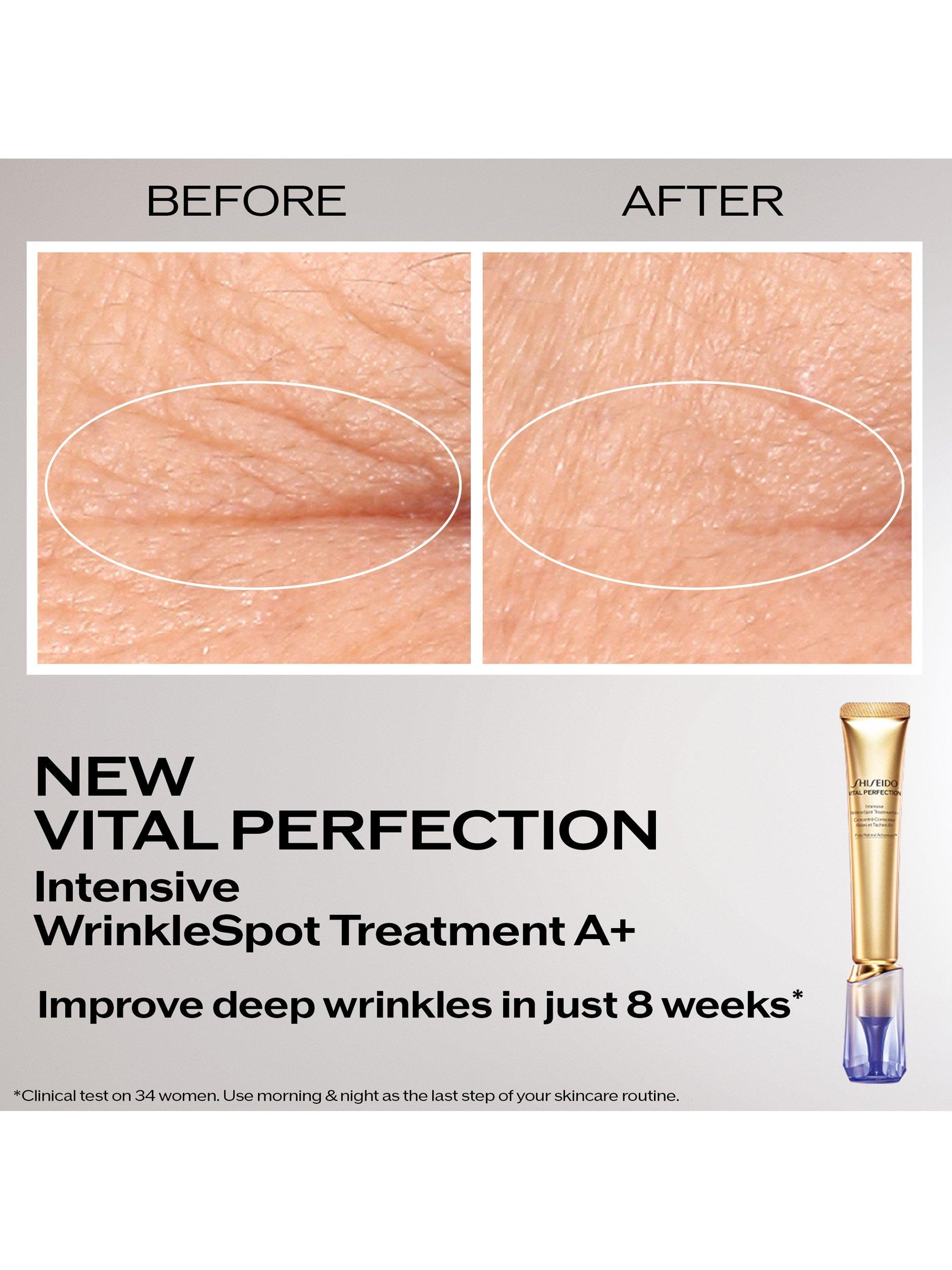 Shiseido WrinkleSpot Treatment A+ 20ml, imported from the UK