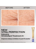 Shiseido WrinkleSpot Treatment A+ 20ml, imported from the UK