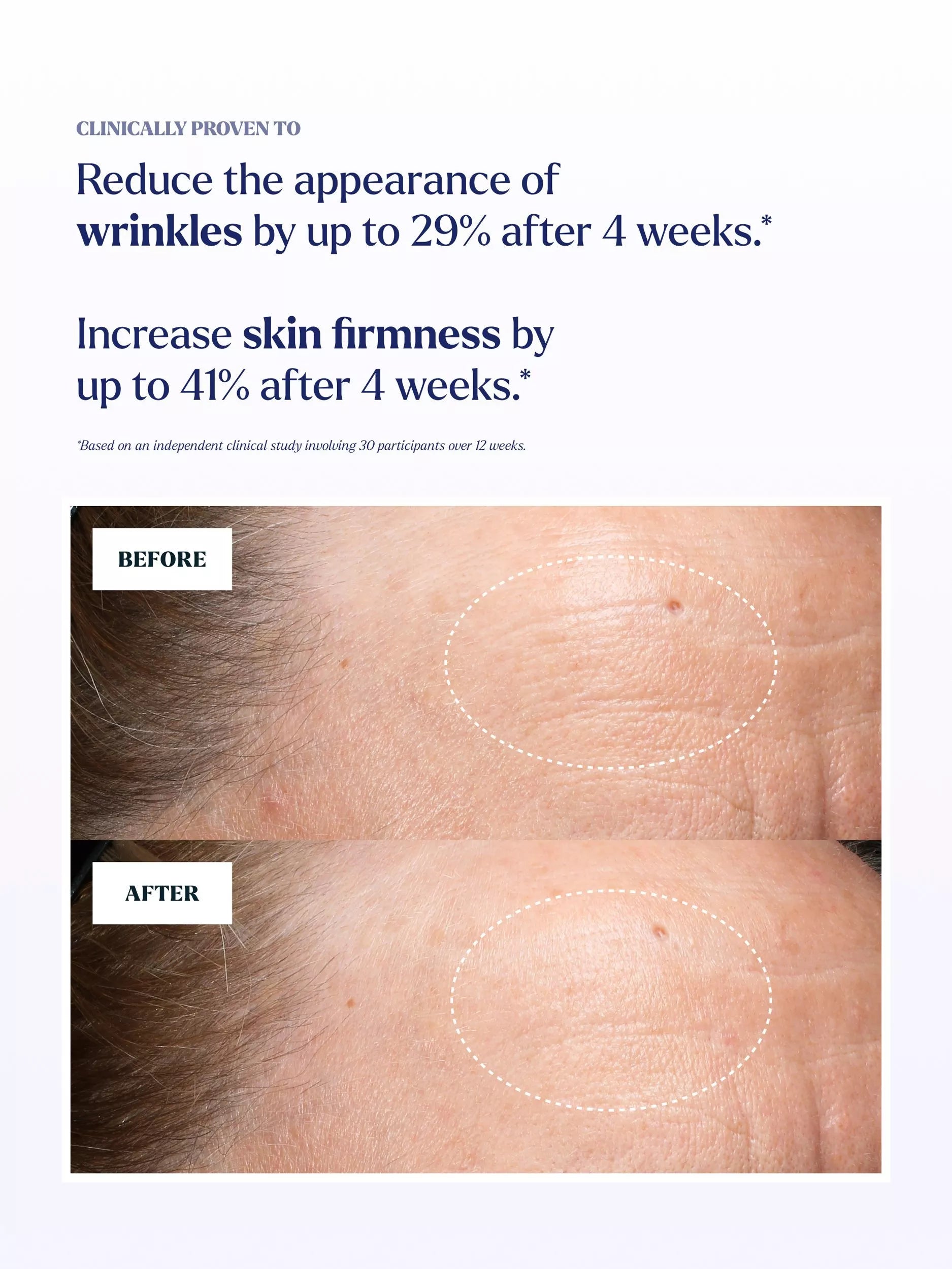 Skin Rocks Retinoid 3 serum 30ml, imported from the UK