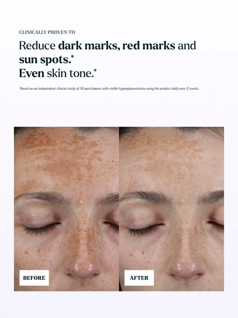 Skin Rocks hyperpigmentation serum refill 30ml, UK version