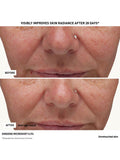 Erborian Micro Shot Advanced 0.3% Serum 10ml, imported from the UK