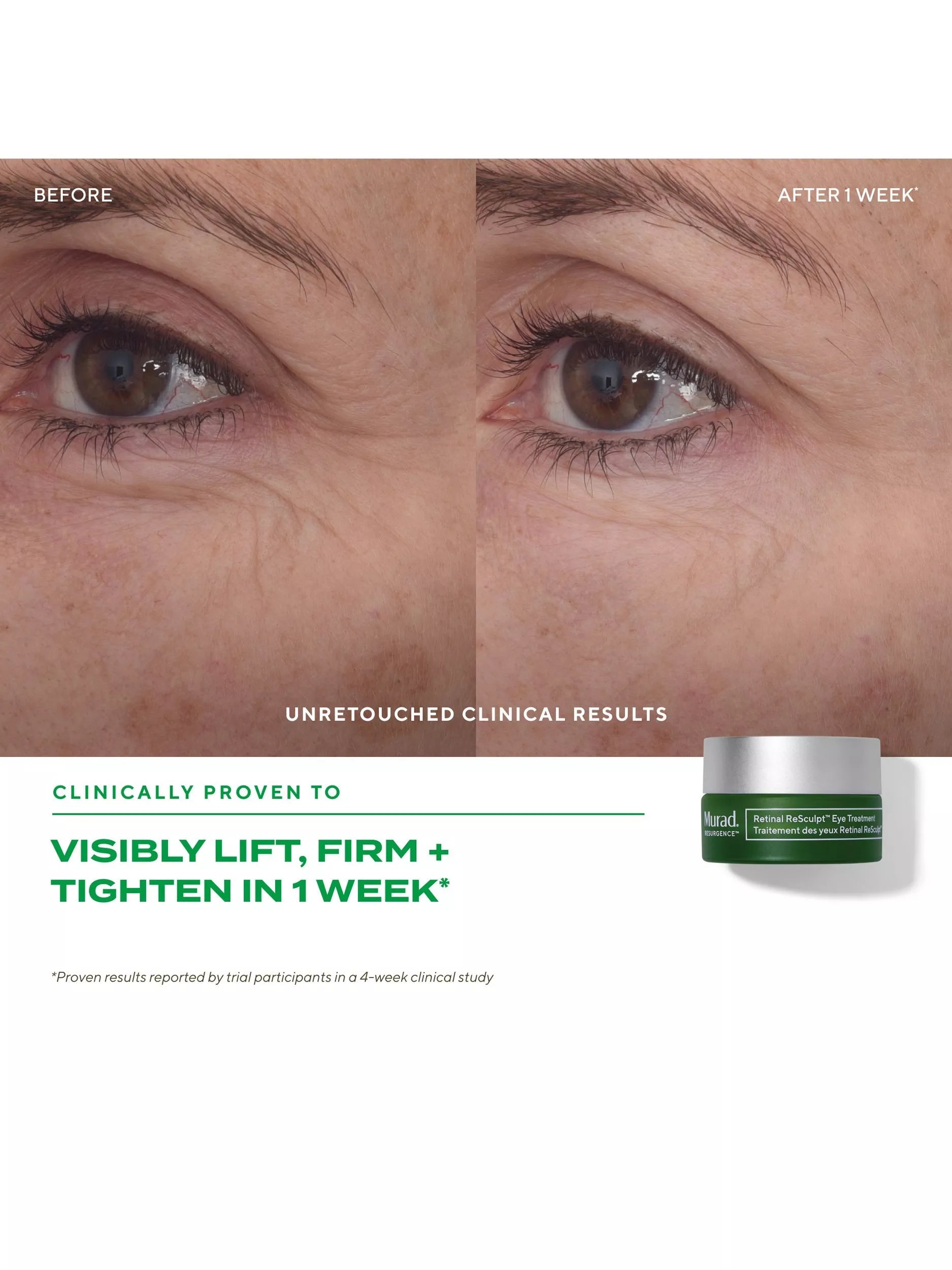 Murad Retinal ReSculpt skincare gift set with treatments - British product