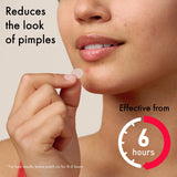 Hero Cosmetics Mighty Patch Duo Pimple Patches 12, imported from the UK