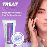 Acnecide Face Wash 5% Gel 50g, UK version