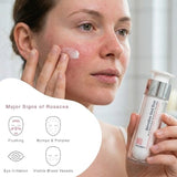 FrezyDerm sensitive red skin facial cream 50ml - British product
