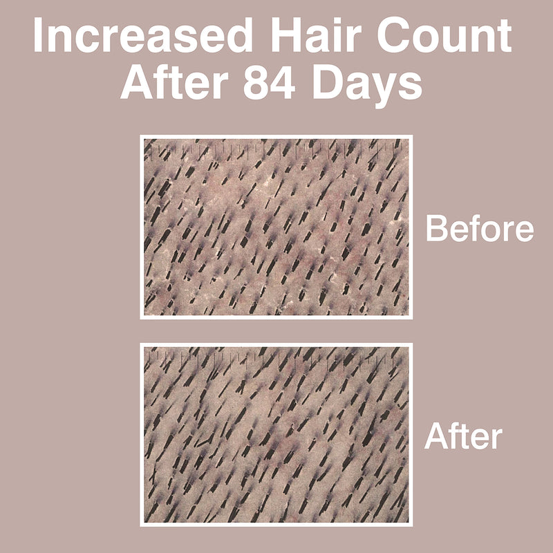 Rio HairGrow laser headband for hair regrowth, imported from the UK