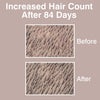Rio HairGrow laser headband for hair regrowth, imported from the UK