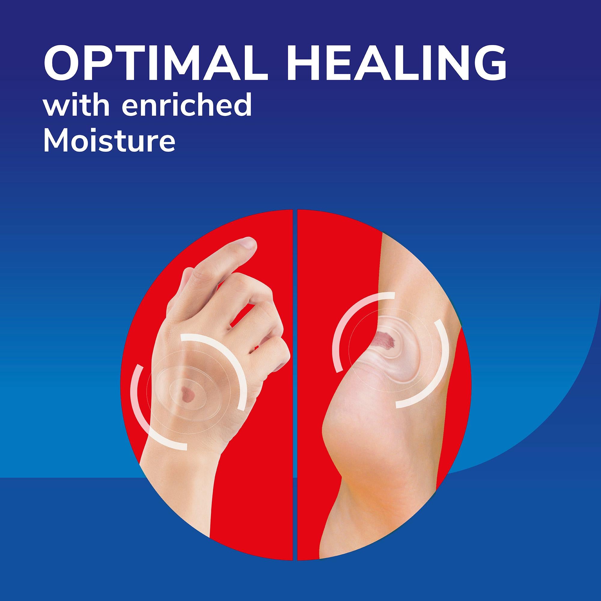 Dr. Scholl's medical grade plasters for open blisters, UK version