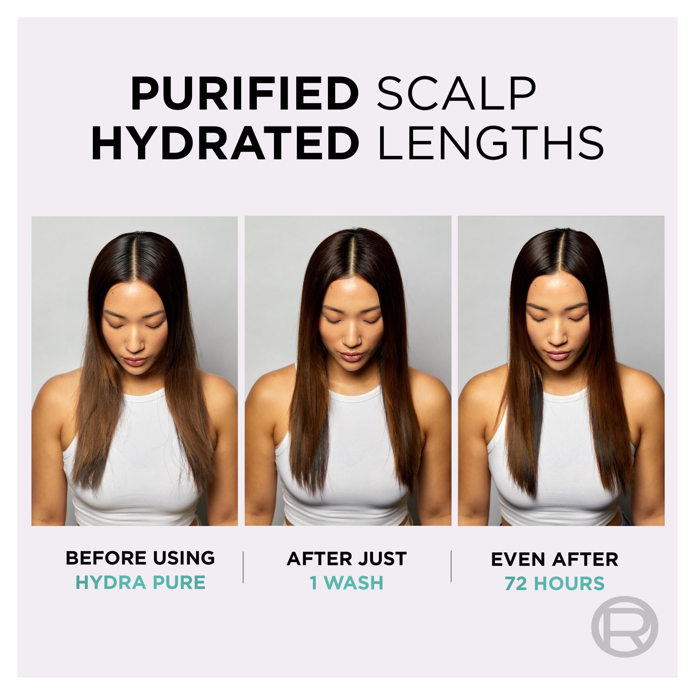 L'Oréal Paris Elvive Hydra Pure Exfoliating Scalp Serum 102ml - British product