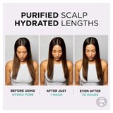 L'Oréal Paris Elvive Hydra Pure Exfoliating Scalp Serum 102ml - British product