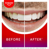 Colgate Max White overnight teeth whitening serum 2.5ml - British product