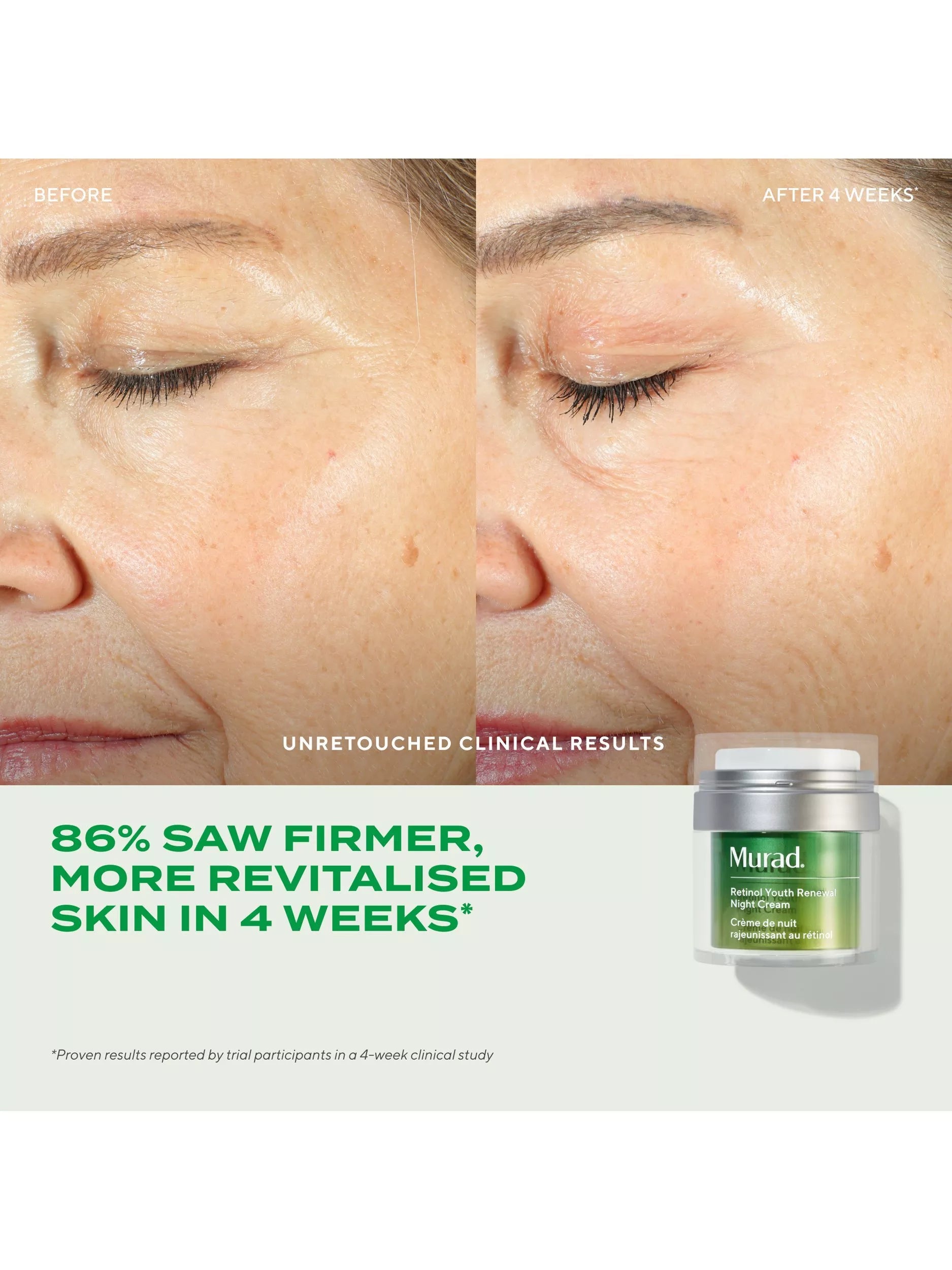 Murad retinol youth renewal night cream 50ml, imported from the UK