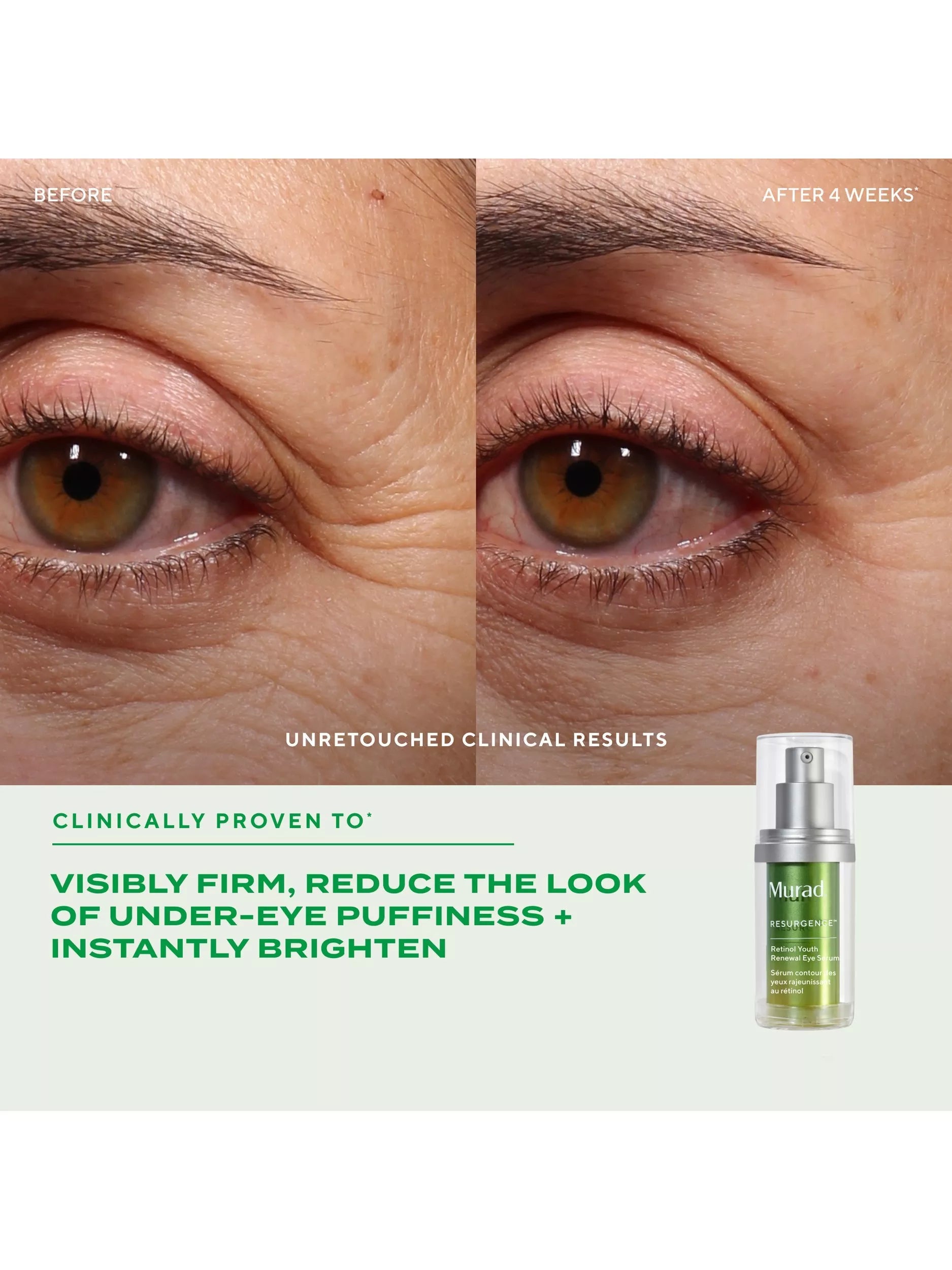 Murad Retinol Youth Renewal eye serum 15ml (British brand)