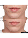 Kate Somerville EradiKate Blemish Treatment 30ml - British product