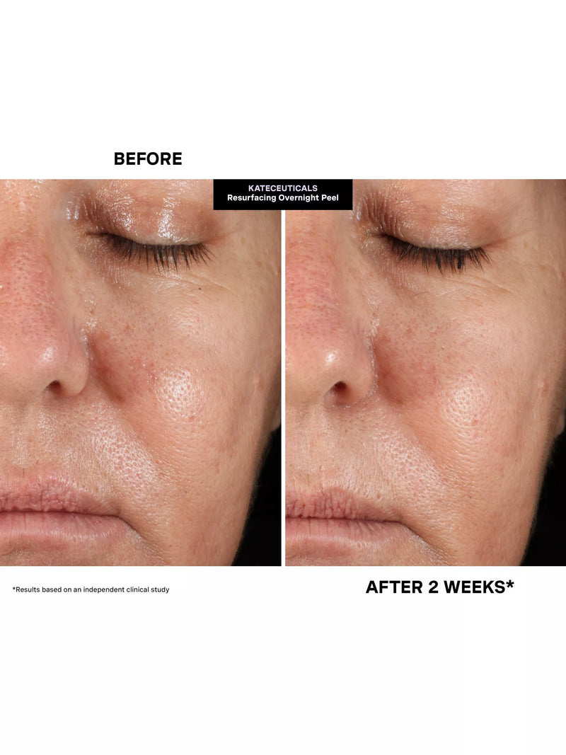 Kate Somerville resurfacing overnight peel 30ml, UK version