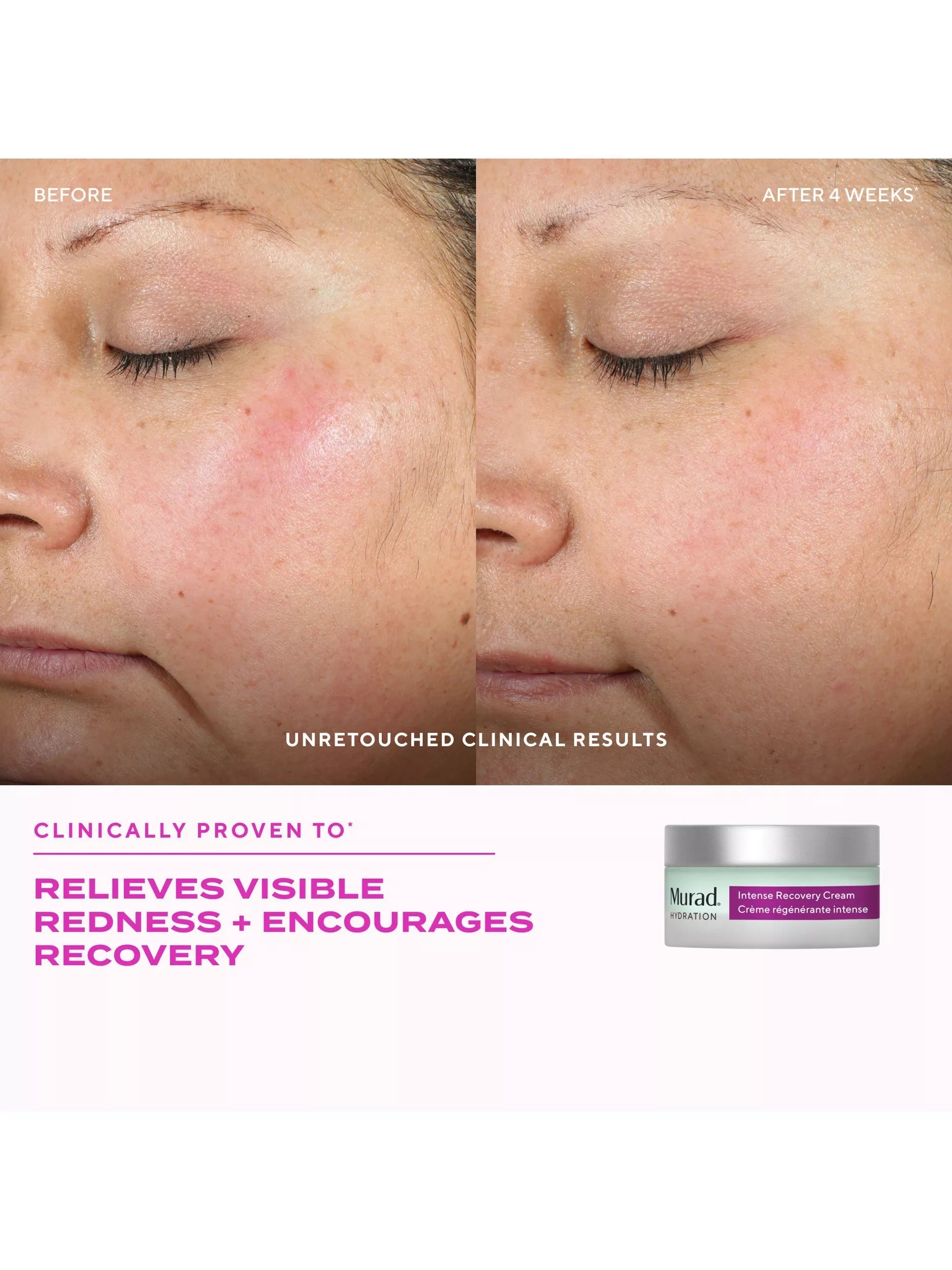 Murad Intense Recovery Cream 50ml skincare (British brand)