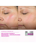 Murad Intense Recovery Cream 50ml skincare (British brand)