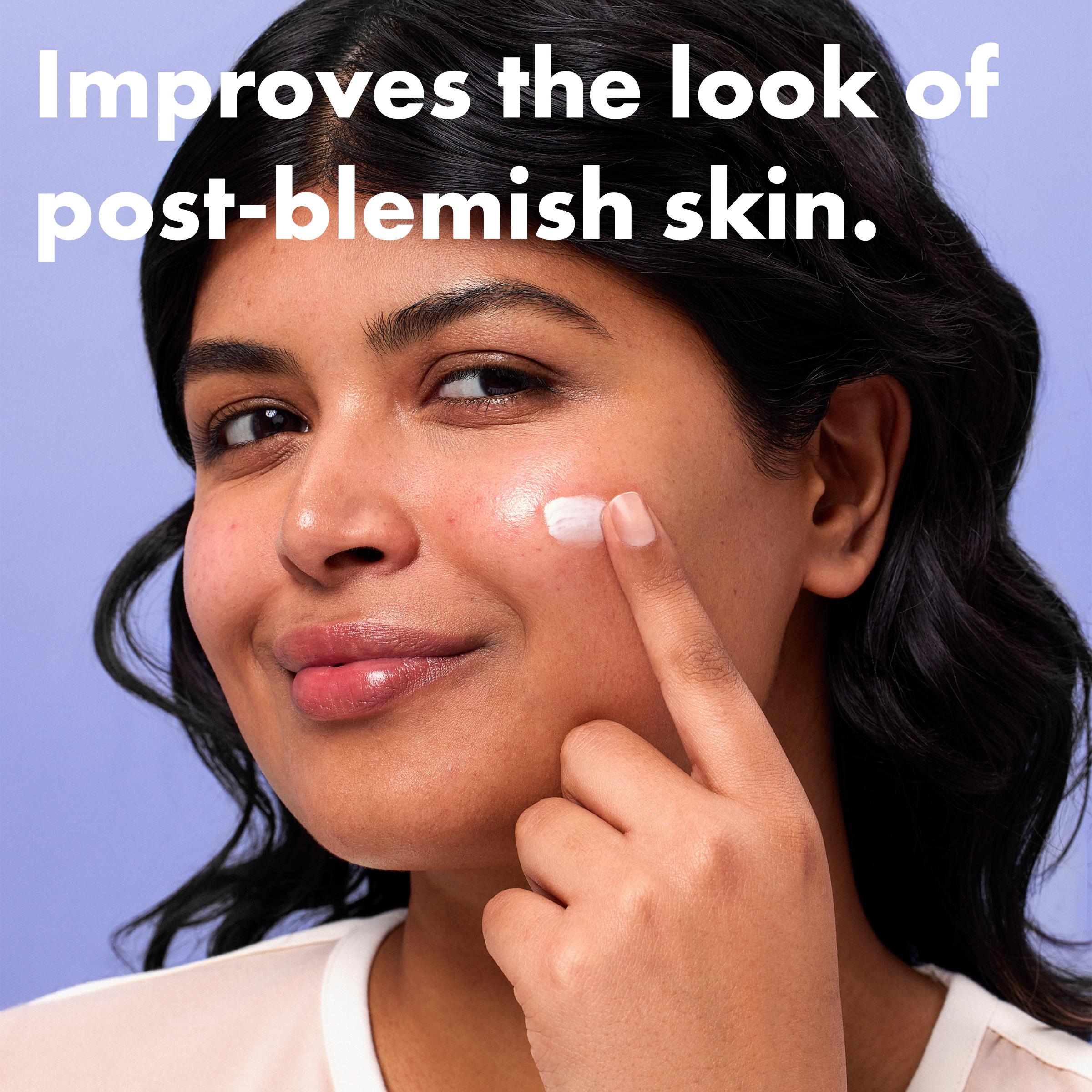 Hero rescue balm post-blemish 15ml - British product