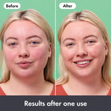 Hero Rescue Balm 15ml colour-correcting cream - British product