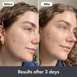 Hero rescue balm post-blemish 15ml - British product