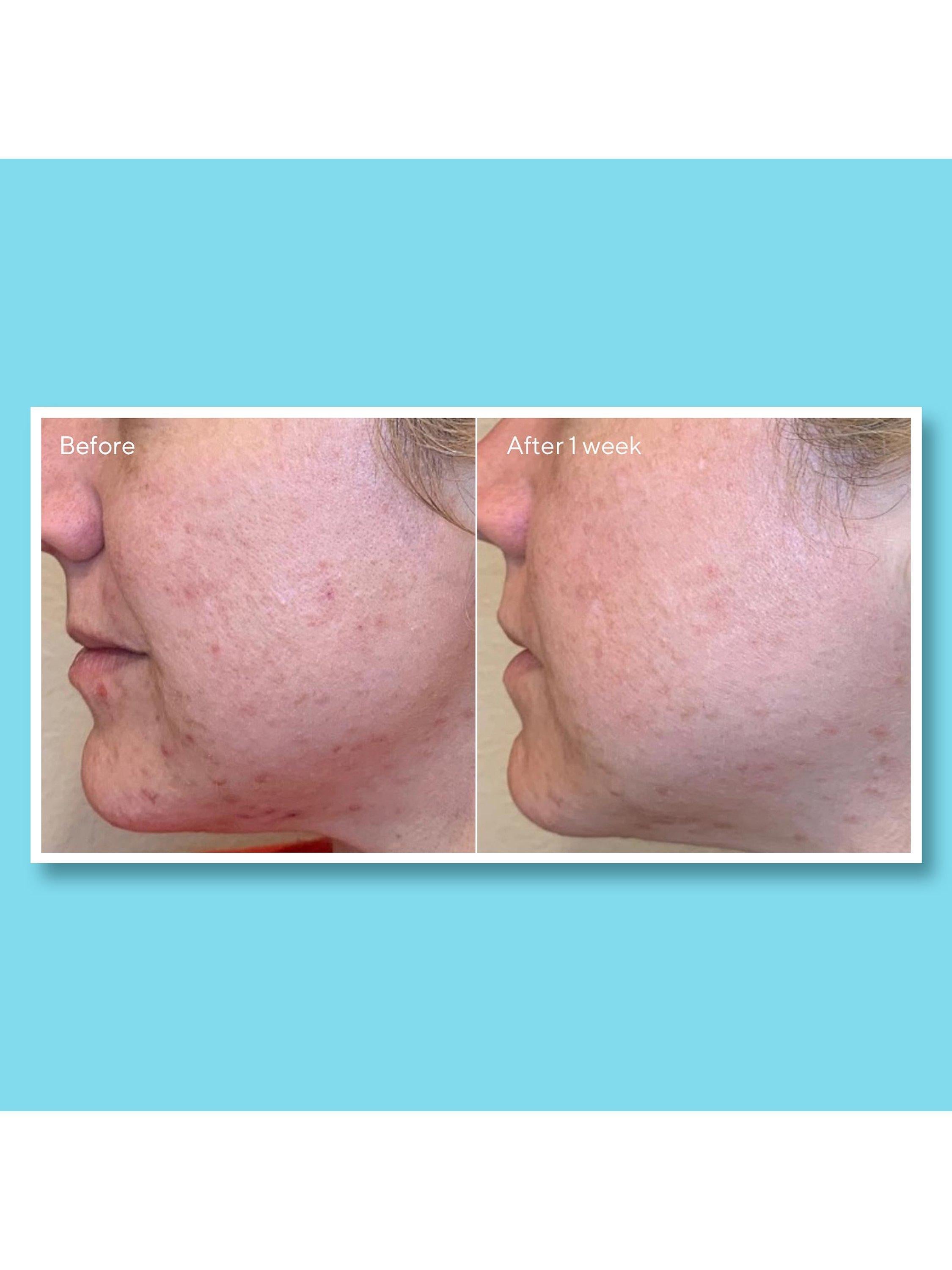 Murad Daily Clarifying Peel 95ml - British product