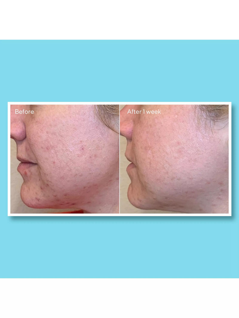 Murad Daily Clarifying Peel 95ml - British product