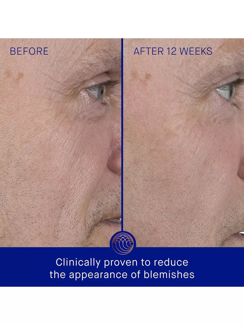 Augustinus Bader Serum Refill 30ml, imported from the UK