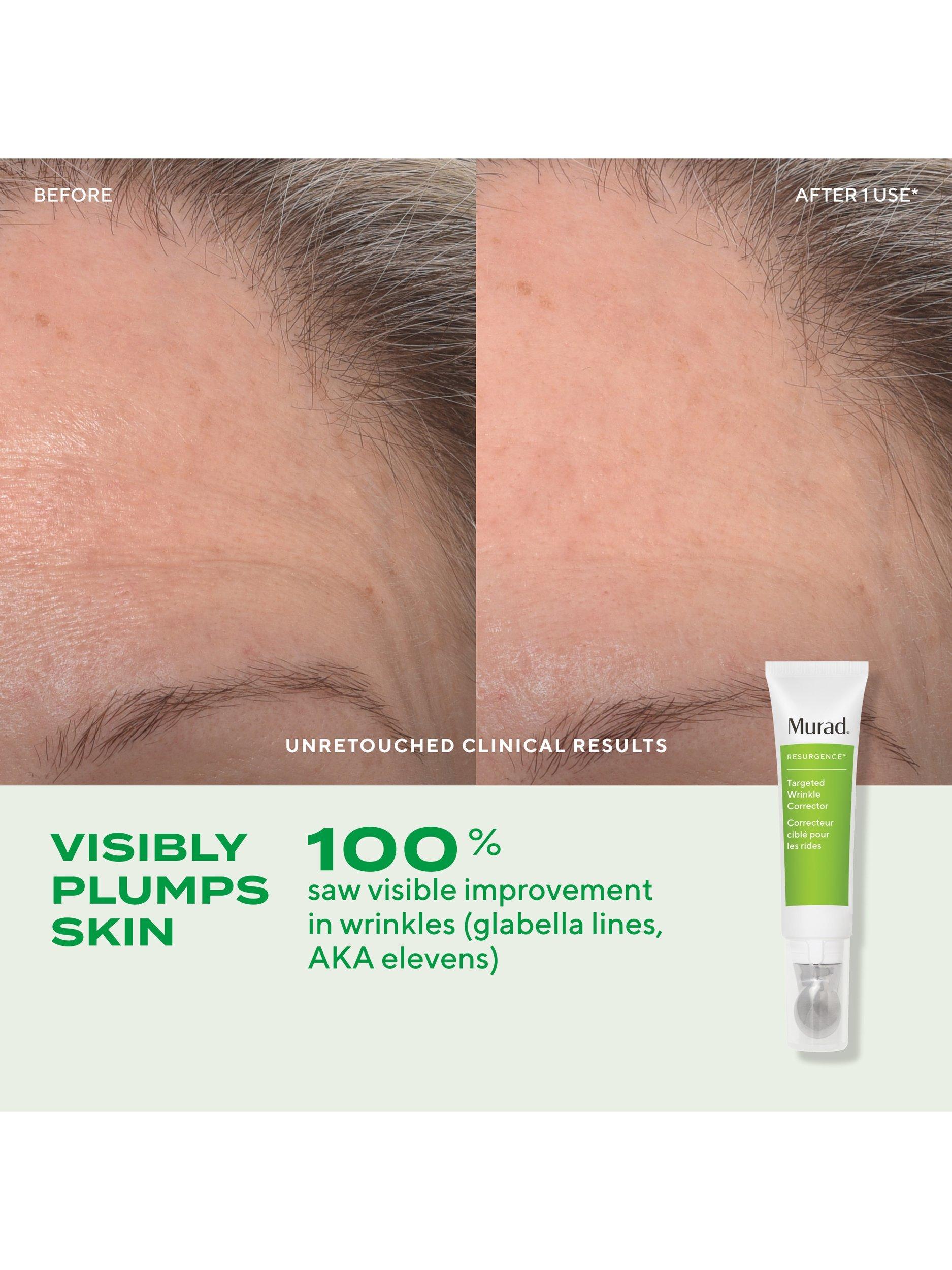 Murad wrinkle corrector retinol serum 15ml, imported from the UK