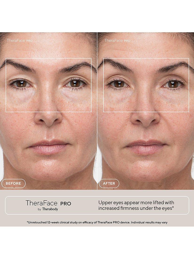 Therabody TheraFace PRO facial health device - British product