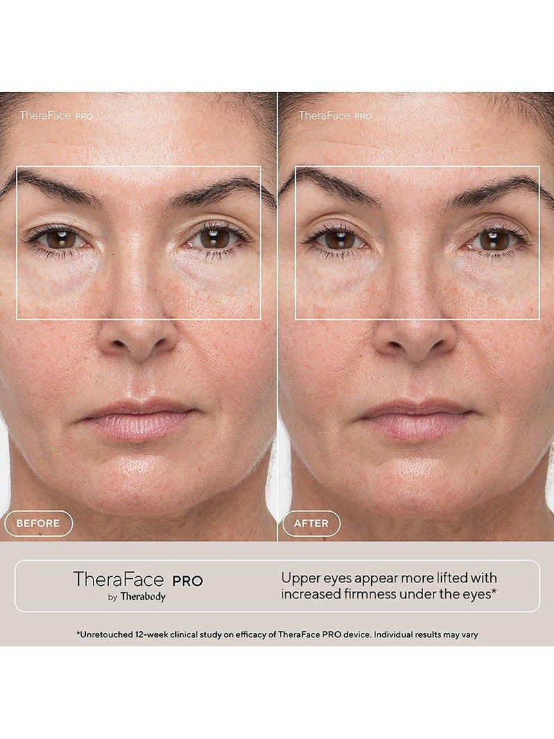 Therabody TheraFace PRO facial health device - British product
