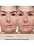 Therabody TheraFace PRO facial health device - British product