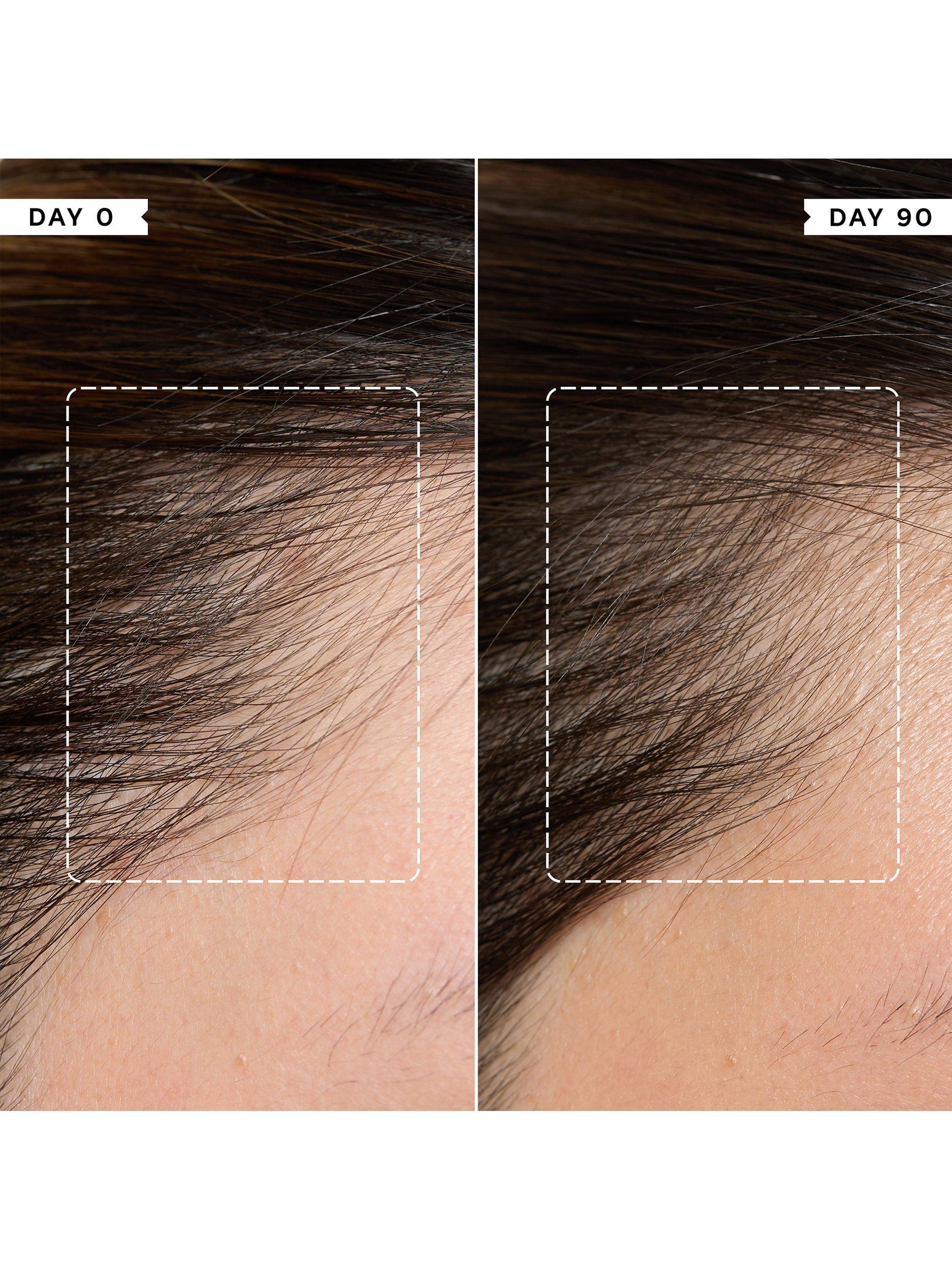 Philip Kingsley Density Preserving Scalp Drops 85ml, imported from the UK