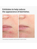 The Ordinary salicylic acid exfoliating serum 30ml, UK version