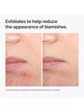 The Ordinary salicylic acid exfoliating serum 30ml, UK version