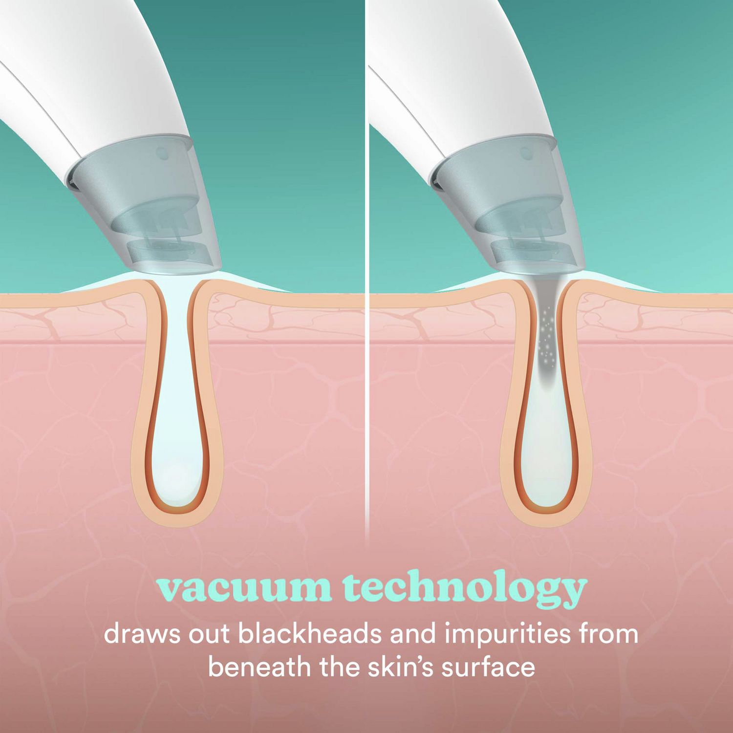 HoMedics Refresh Hydra Facial hydradermabrasion tool - British product