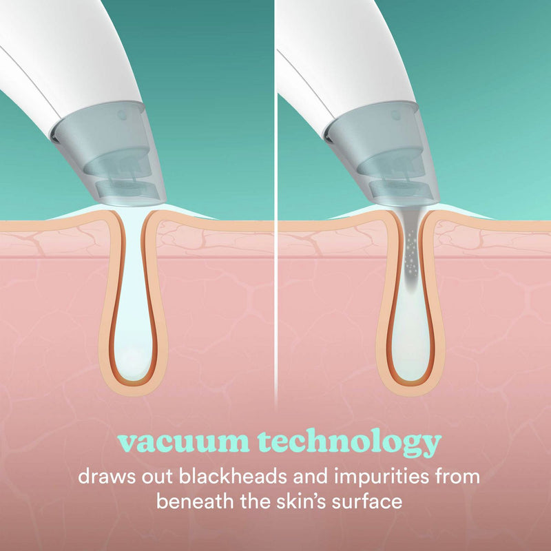 HoMedics Refresh Hydra Facial hydradermabrasion tool - British product