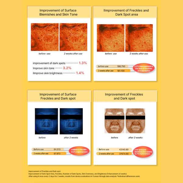 Acropass dark spot microneedle patches 6 pack - British product