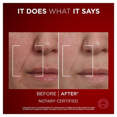 Superdrug L'Oréal Paris Crème de Jour Laser Renew 50ml - Acheter en ligne sur McGrocer