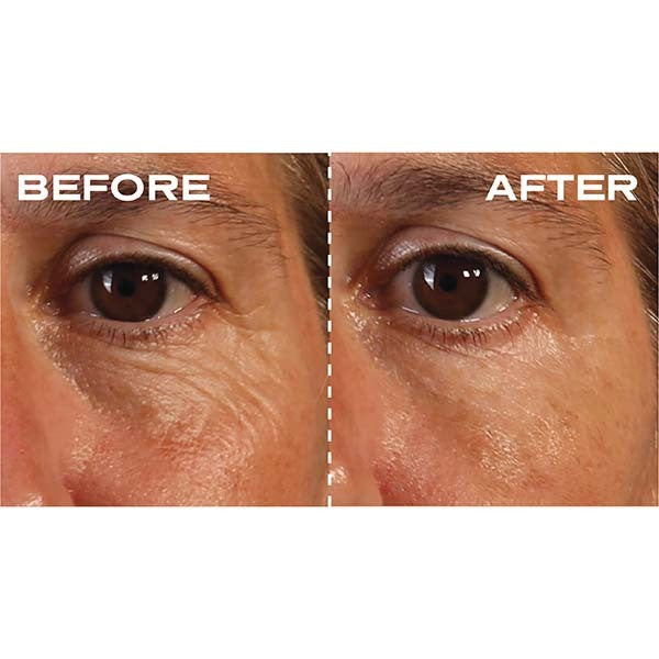 Facial Dermal Filler Plump It Pods 15 Units imported from the UK