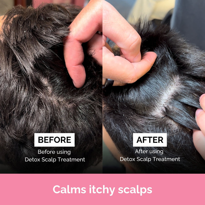 Ful Detox Scalp Treatment 150ml for dry scalp, UK version