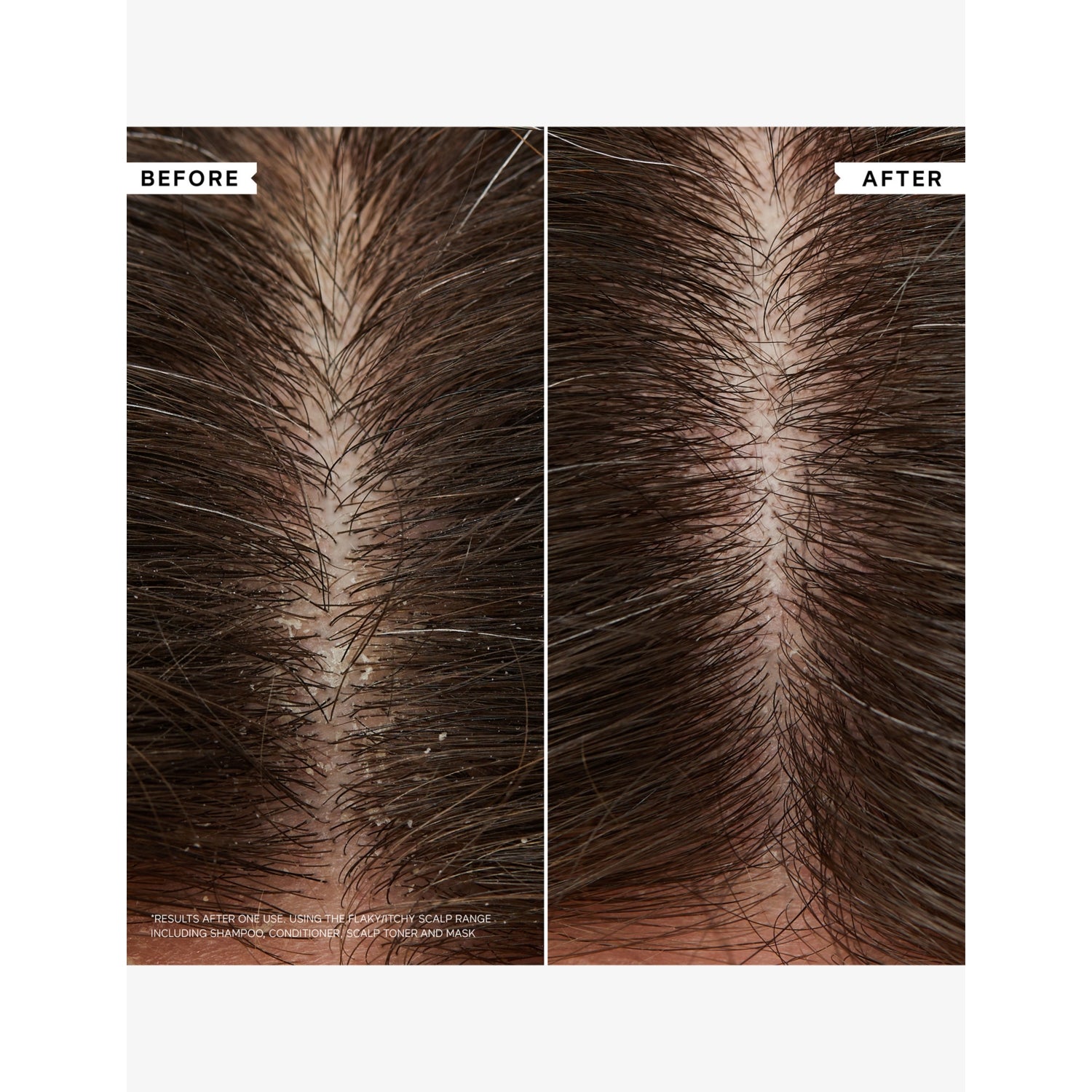 Philip Kingsley Flaky Itchy Scalp Shampoo - British product