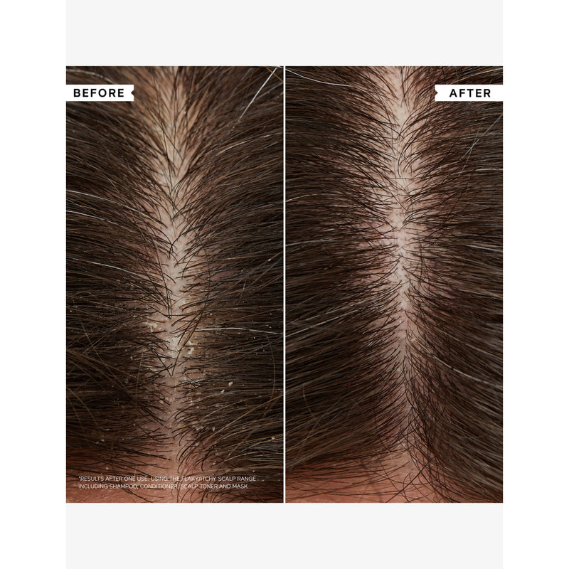 Philip Kingsley Flaky Itchy Scalp Shampoo - British product