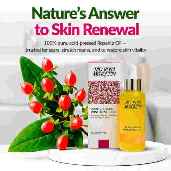 Rio Rosa Mosqueta Rosehip Seed Oil 20ml, UK version