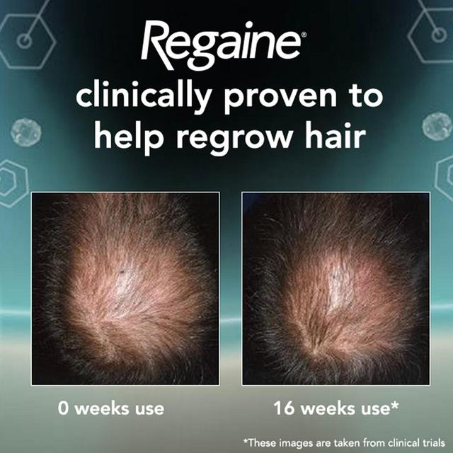 Regaine for Men Extra Strength Hair Regrowth Scalp Foam (3 month supply)   3 per pack GOODS M&S   