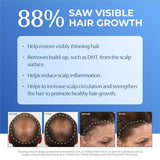 BosleyMD Thinning Hair Shampoo 1L - British product