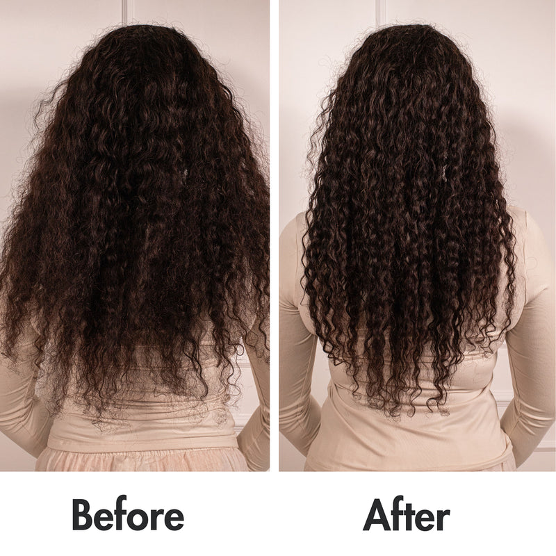 Hair Loving hair regrowth bundle 50ml oil and derma roller - British product