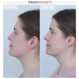 MAGNITON FaceRocket 5-in-1 facial massager - British product