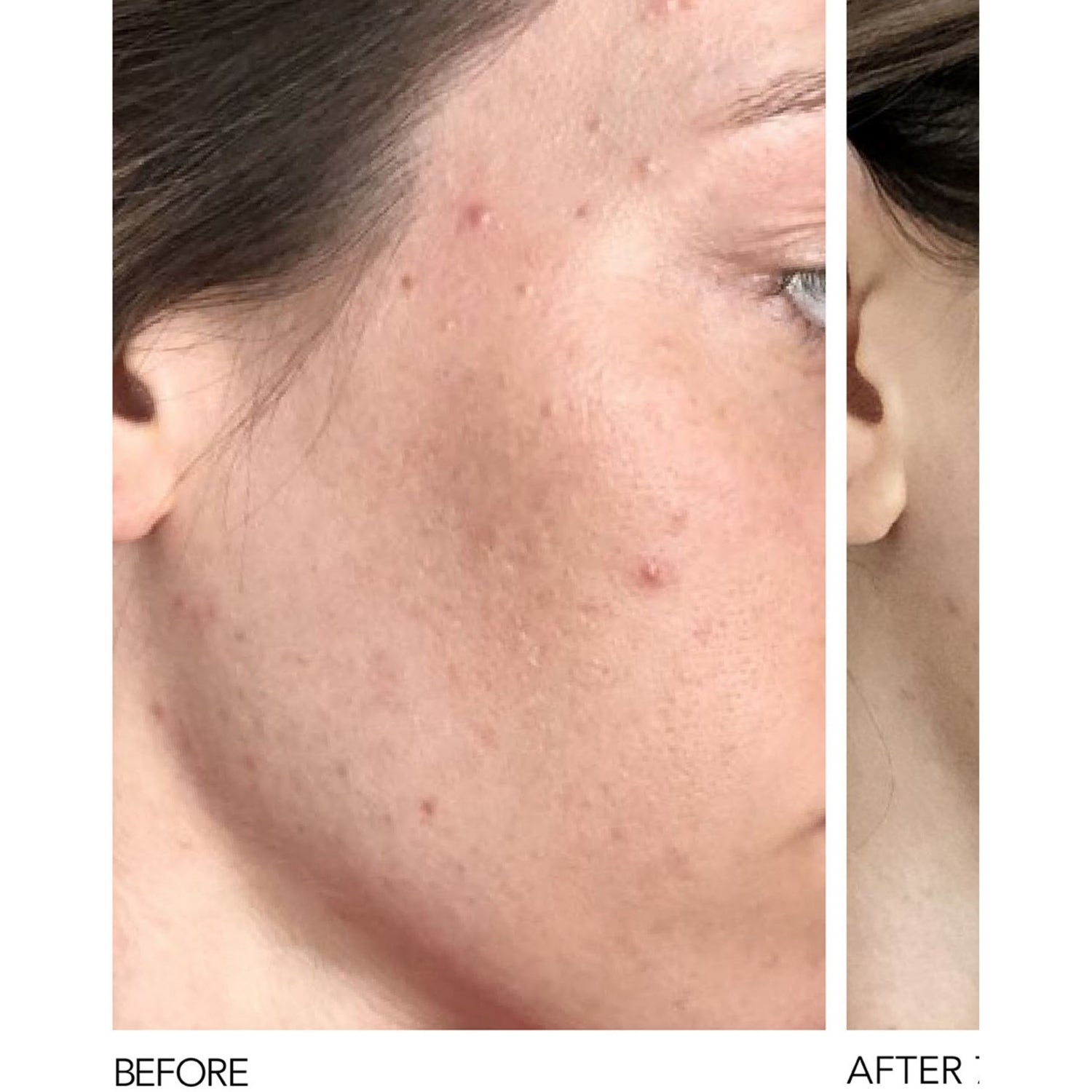 Dr Dennis Gross Alpha Beta peel pads 30 uses - British product