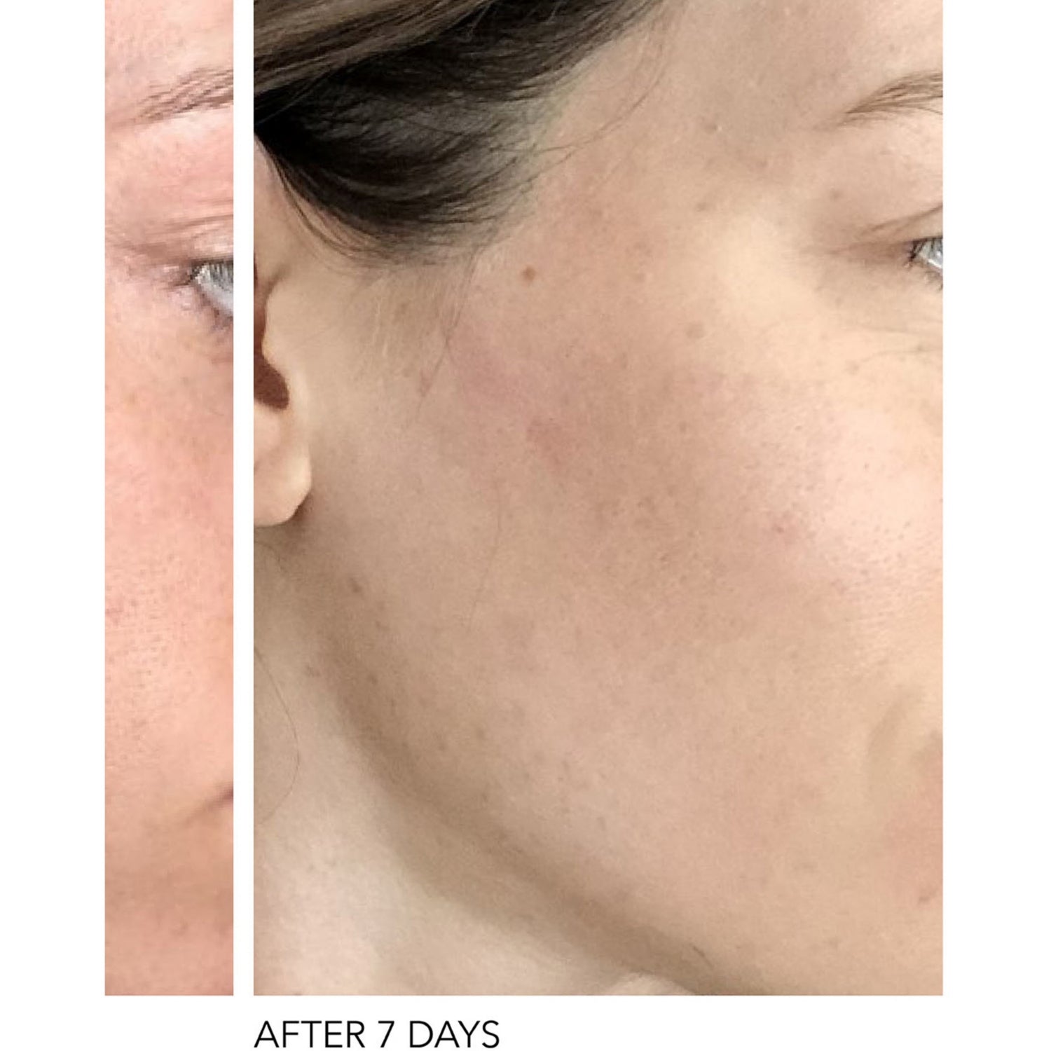 Dr Dennis Gross Alpha Beta peel pads 30 uses - British product
