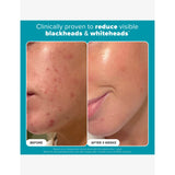 Paula's Choice 2% BHA exfoliating toner 30ml (British brand)